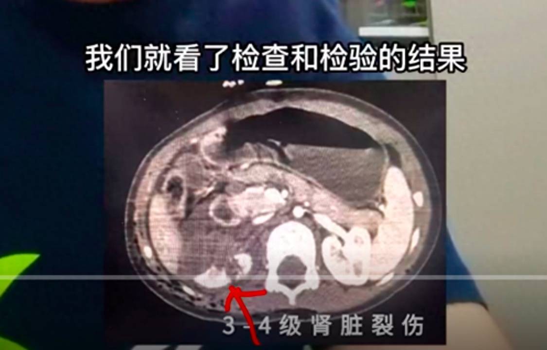 保洁阿姨为2岁女童挡狗获网友点赞物业回应：打算给一些奖励还没公布jbo竞博(图6)